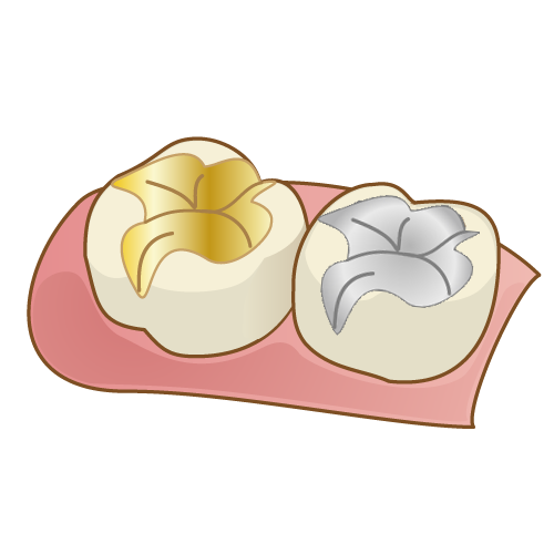 金合金 白金加金