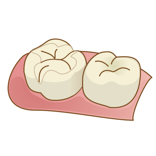 セラミック